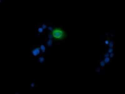 Immunocytochemistry/ Immunofluorescence: MDMX Antibody (OTI4G5) [NBP2-45779]