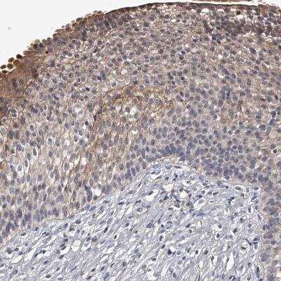 Immunohistochemistry: MDN1 Antibody [NBP1-81521]