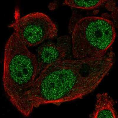 Immunocytochemistry/ Immunofluorescence: MDP1 Antibody [NBP1-83431]