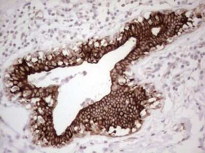 Immunohistochemistry: MDR1/ABCB1 Antibody (OTI1A7) [NBP2-46466]