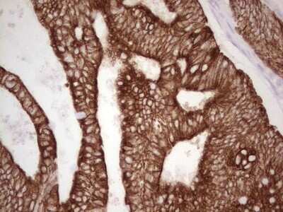 Immunohistochemistry: MDR1/ABCB1 Antibody (OTI1A7) [NBP2-46466]