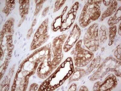 Immunohistochemistry: MDR1/ABCB1 Antibody (OTI1A7) [NBP2-46466]