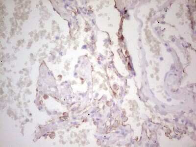 Immunohistochemistry: MDR1/ABCB1 Antibody (OTI1A7) [NBP2-46466]