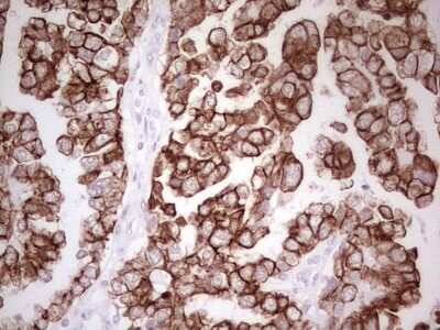 Immunohistochemistry: MDR1/ABCB1 Antibody (OTI1A7) [NBP2-46466]