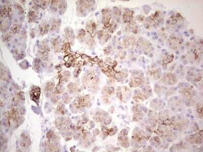 Immunohistochemistry: MDR1/ABCB1 Antibody (OTI1A7) [NBP2-46466]