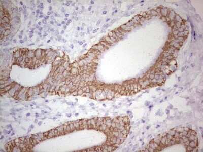 Immunohistochemistry: MDR1/ABCB1 Antibody (OTI1A7) [NBP2-46466]