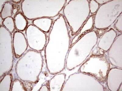 Immunohistochemistry: MDR1/ABCB1 Antibody (OTI1A7) [NBP2-46466]