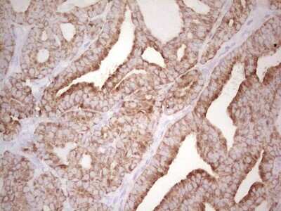 Immunohistochemistry: MDR1/ABCB1 Antibody (OTI1A7) [NBP2-46466]