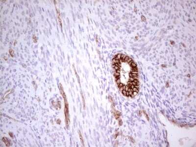 Immunohistochemistry: MDR1/ABCB1 Antibody (OTI1A7) [NBP2-46466]