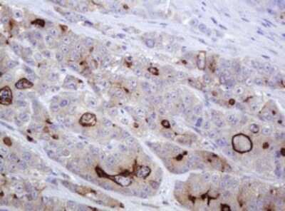 Immunohistochemistry: MDR1/ABCB1 Antibody (OTI3B2) [NBP2-46465]