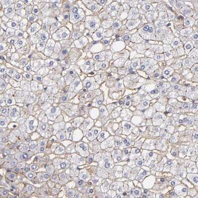 Immunohistochemistry-Paraffin: MDR1/ABCB1 Antibody [NBP1-90291]