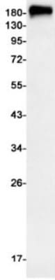 Western Blot: MDR1/ABCB1 Antibody (S02-6B2) [NBP3-20044]