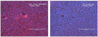 Immunohistochemistry-Frozen: MDR1/ABCB1 Antibody (SN06-42) [NBP2-67667]