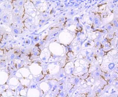 Immunohistochemistry-Paraffin: MDR1/ABCB1 Antibody (SN06-42) [NBP2-67667]