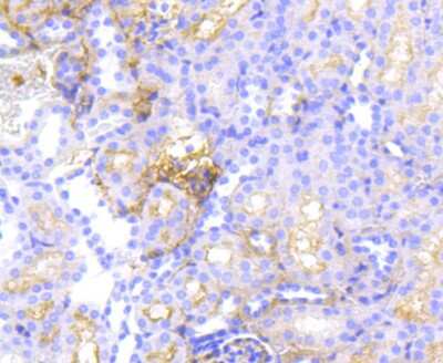 Immunohistochemistry-Paraffin: MDR1/ABCB1 Antibody (SN06-42) [NBP2-67667]