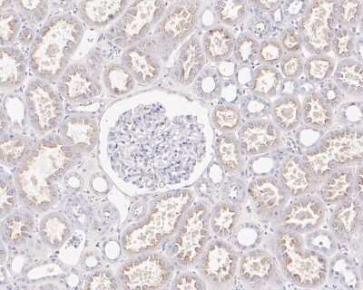 Immunohistochemistry-Paraffin: MDR1/ABCB1 Antibody (SN06-42) [NBP2-67667]
