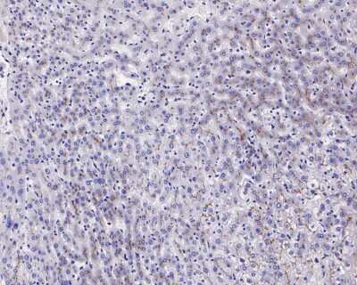 Immunohistochemistry-Paraffin: MDR1/ABCB1 Antibody (SN06-42) [NBP2-67667]