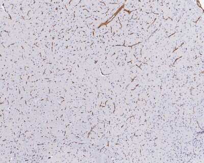 Immunohistochemistry-Paraffin: MDR1/ABCB1 Antibody (SN06-42) [NBP2-67667]