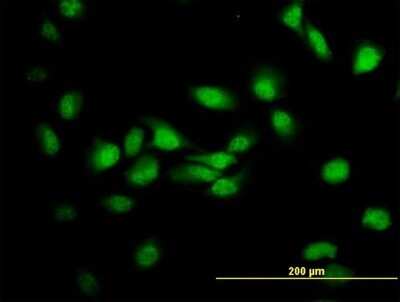 Immunocytochemistry/ Immunofluorescence: MDS028 Antibody (3D4) [H00055846-M05]