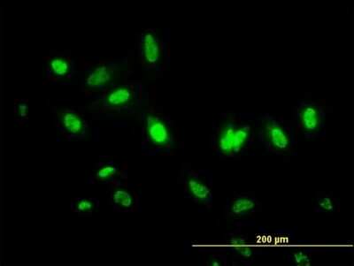 Immunocytochemistry/ Immunofluorescence: MDS028 Antibody (3D7) [H00055846-M06]
