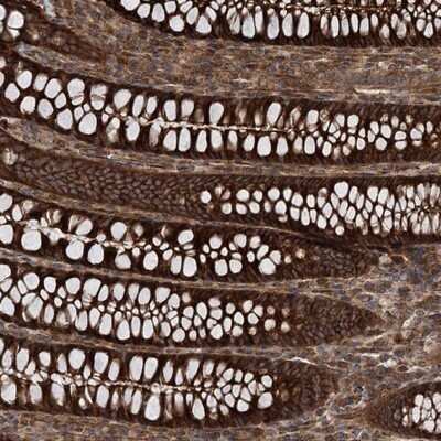 Immunohistochemistry-Paraffin: MDS028 Antibody [NBP1-92103]