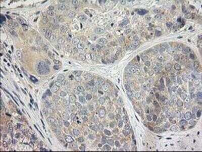 Immunohistochemistry: MDS028 Antibody (OTI3C4) - Azide and BSA Free [NBP2-72614]