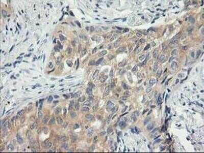 Immunohistochemistry: MDS028 Antibody (OTI3C4) - Azide and BSA Free [NBP2-72614]