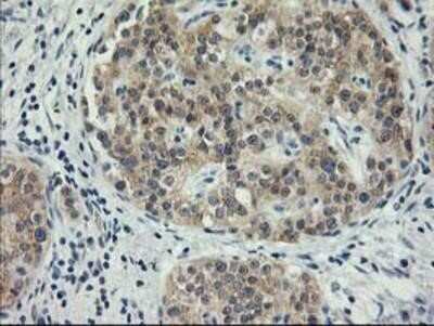 Immunohistochemistry: MDS028 Antibody (OTI3C4) - Azide and BSA Free [NBP2-72614]