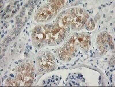 Immunohistochemistry: MDS028 Antibody (OTI3C4) - Azide and BSA Free [NBP2-72614]