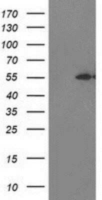 Western Blot: MDS028 Antibody (OTI3C4)Azide and BSA Free [NBP2-72614]