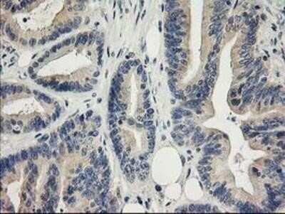 Immunohistochemistry-Paraffin: MDS028 Antibody (OTI3C4) [NBP2-00860]