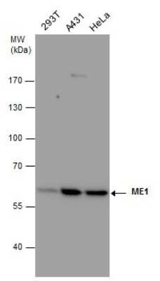 Western Blot: ME1 Antibody (15611) [NBP2-43669]