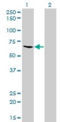 Western Blot: ME1 Antibody (3H5) [H00004199-M03]