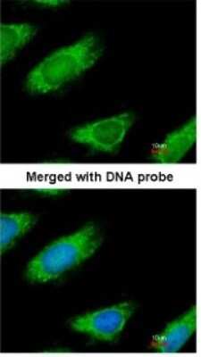 Immunocytochemistry/ Immunofluorescence: ME1 Antibody [NBP1-32398]