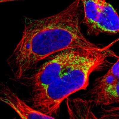 Immunocytochemistry/ Immunofluorescence: ME2 Antibody [NBP1-82434]