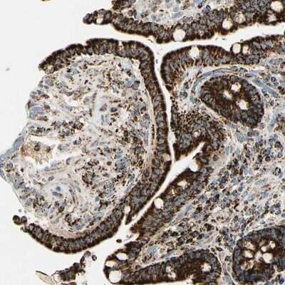 Immunohistochemistry-Paraffin: ME2 Antibody [NBP1-82434]