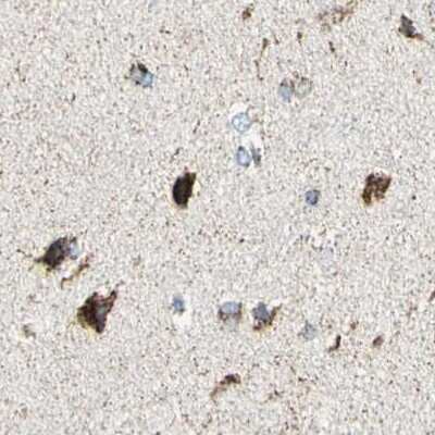 Immunohistochemistry-Paraffin: ME2 Antibody [NBP1-82434]
