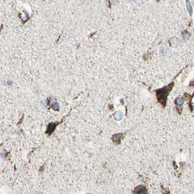 Immunohistochemistry-Paraffin: ME2 Antibody [NBP1-89559]