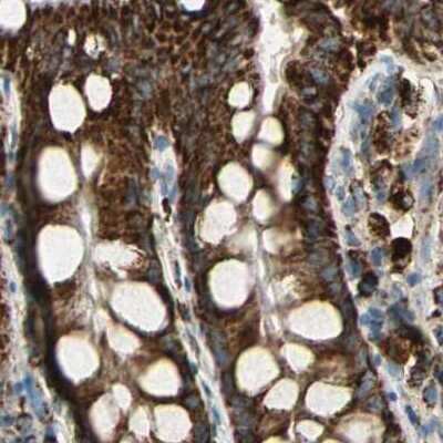 Immunohistochemistry-Paraffin: ME2 Antibody [NBP1-89559]
