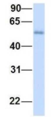 Western Blot: ME2 Antibody [NBP1-54765]