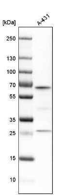 Western Blot: ME2 Antibody [NBP1-82434]