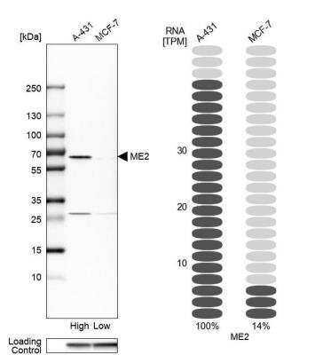 Western Blot: ME2 Antibody [NBP1-82434]