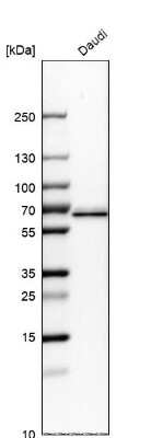 Western Blot: ME2 Antibody [NBP1-89559]