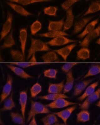 Immunocytochemistry/ Immunofluorescence: ME3 Antibody - Azide and BSA Free [NBP3-05078]