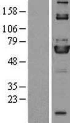 Western Blot: ME3 Overexpression Lysate [NBP2-08745]