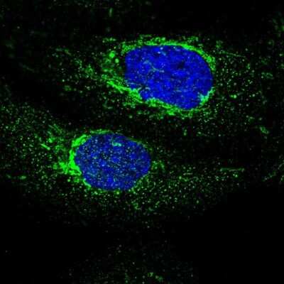 Immunocytochemistry/ Immunofluorescence: MECR Antibody [NBP1-85657]