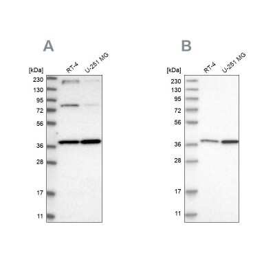 Western Blot: MECR Antibody [NBP1-85659]