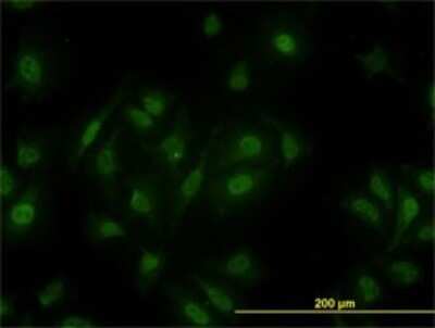 Immunocytochemistry/ Immunofluorescence: MED15 Antibody (4A4) [H00051586-M02]
