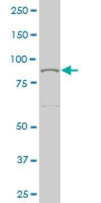Western Blot: MED16 Antibody (2B7) [H00010025-M02]