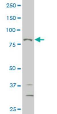 Western Blot: MED16 Antibody (3B10) [H00010025-M03]
